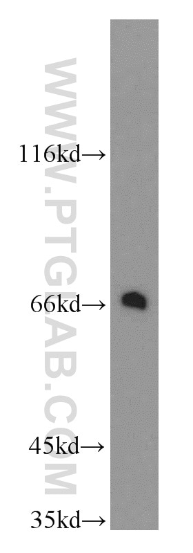 Western Blot (WB) analysis of mouse liver tissue using TGFBI / BIGH3 Polyclonal antibody (10188-1-AP)