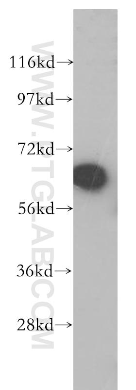 Western Blot (WB) analysis of human kidney tissue using TGFBI / BIGH3 Polyclonal antibody (10188-1-AP)