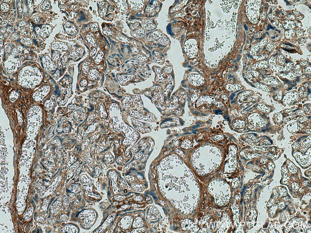 Immunohistochemistry (IHC) staining of human placenta tissue using TGFBI / BIGH3 Monoclonal antibody (60007-1-Ig)