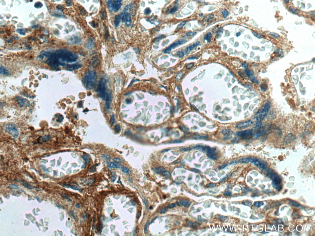 IHC staining of human placenta using 60007-1-Ig