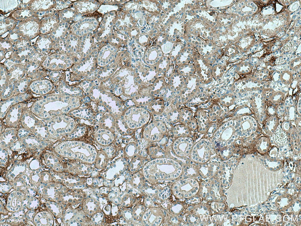 Immunohistochemistry (IHC) staining of human kidney tissue using TGFBI / BIGH3 Monoclonal antibody (60007-1-Ig)