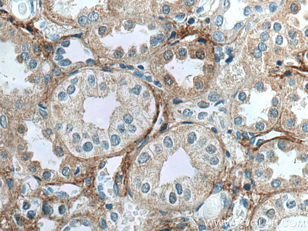 Immunohistochemistry (IHC) staining of human kidney tissue using TGFBI / BIGH3 Monoclonal antibody (60007-1-Ig)