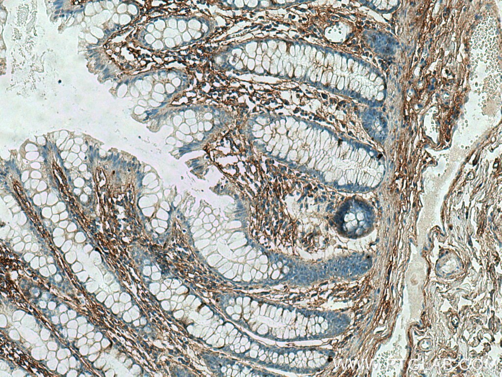 IHC staining of human colon using 60007-1-Ig