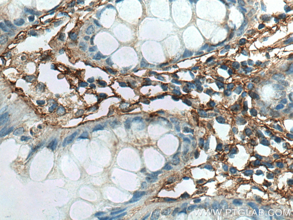 Immunohistochemistry (IHC) staining of human colon tissue using TGFBI / BIGH3 Monoclonal antibody (60007-1-Ig)