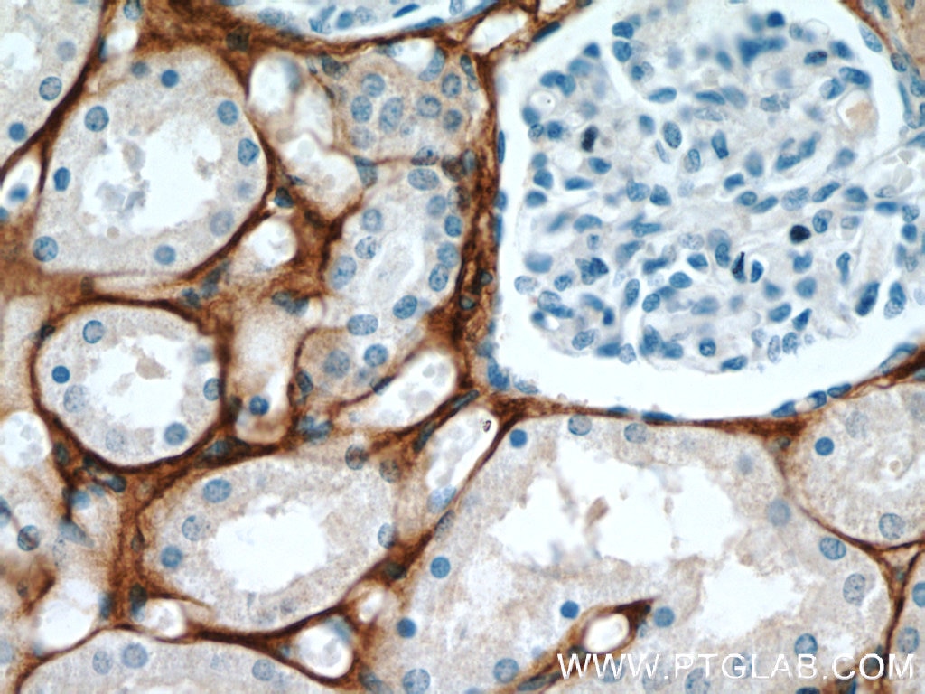 TGFBI / BIGH3 Monoclonal antibody