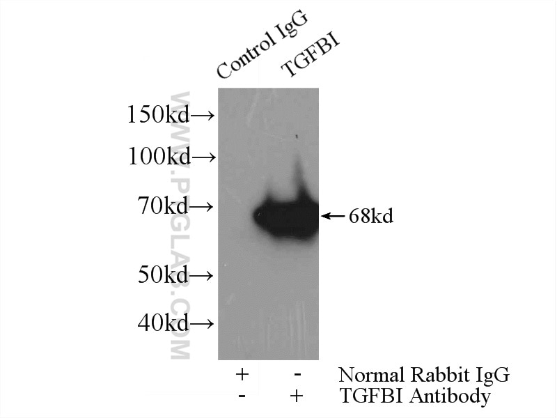 Immunoprecipitation (IP) experiment of HeLa cells using TGFBI / BIGH3 Monoclonal antibody (60007-1-Ig)