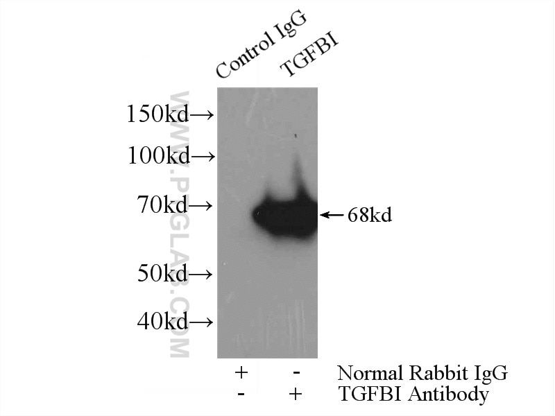 IP experiment of HeLa using 60007-1-Ig