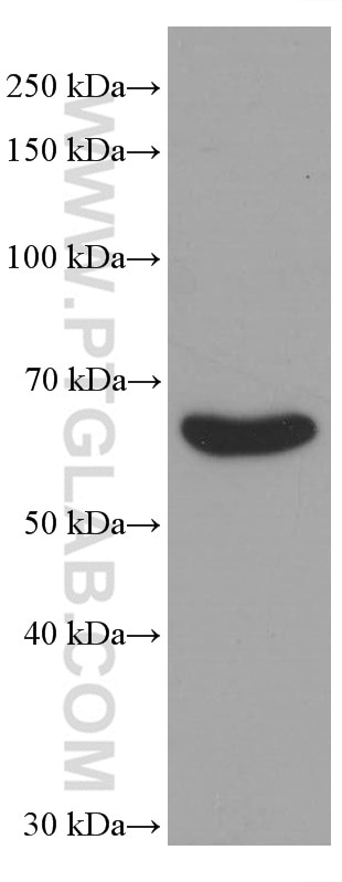Western Blot (WB) analysis of human kidney tissue using TGFBI / BIGH3 Monoclonal antibody (60007-1-Ig)