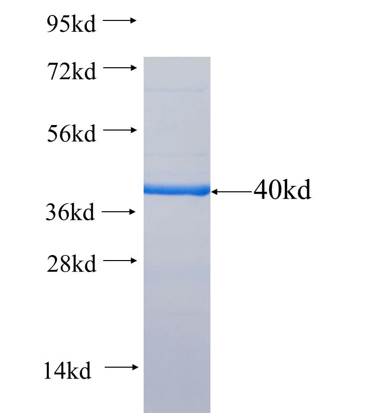 BIM, BCL2L11 fusion protein Ag26122 SDS-PAGE
