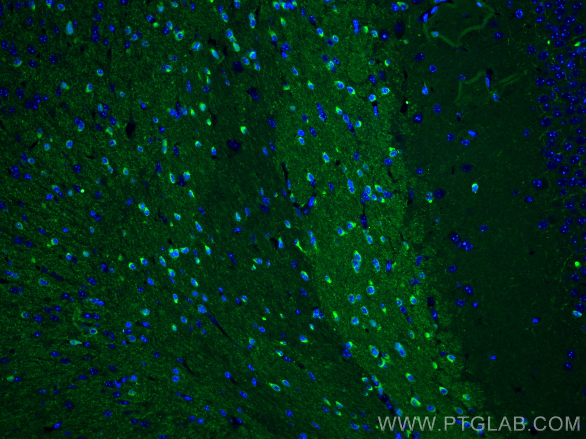 Immunofluorescence (IF) / fluorescent staining of mouse brain tissue using BIN1 Polyclonal antibody (14647-1-AP)