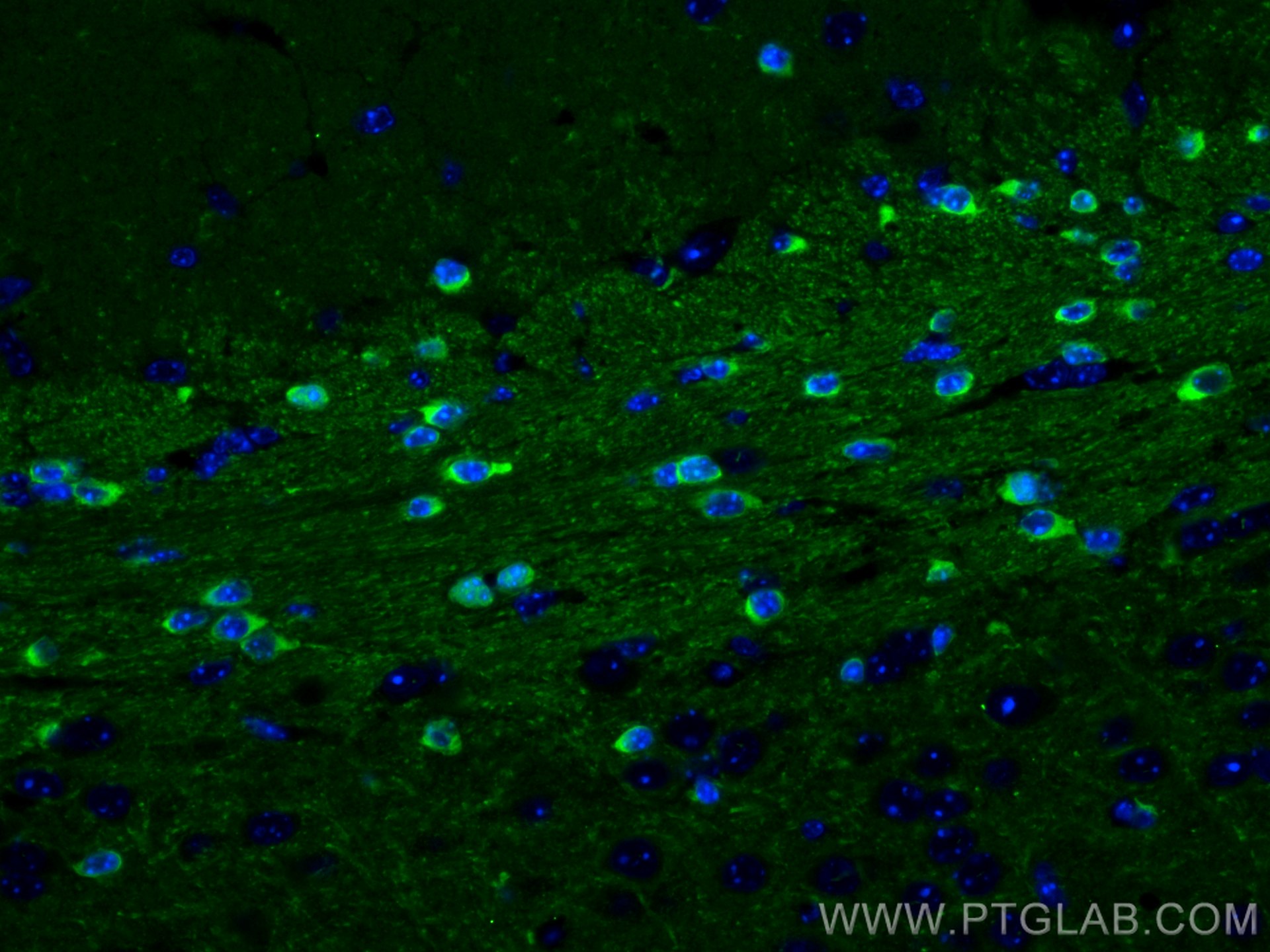 Immunofluorescence (IF) / fluorescent staining of mouse brain tissue using BIN1 Polyclonal antibody (14647-1-AP)