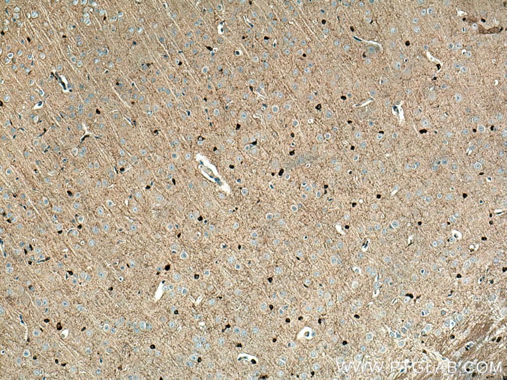 IHC staining of mouse brain using 14647-1-AP