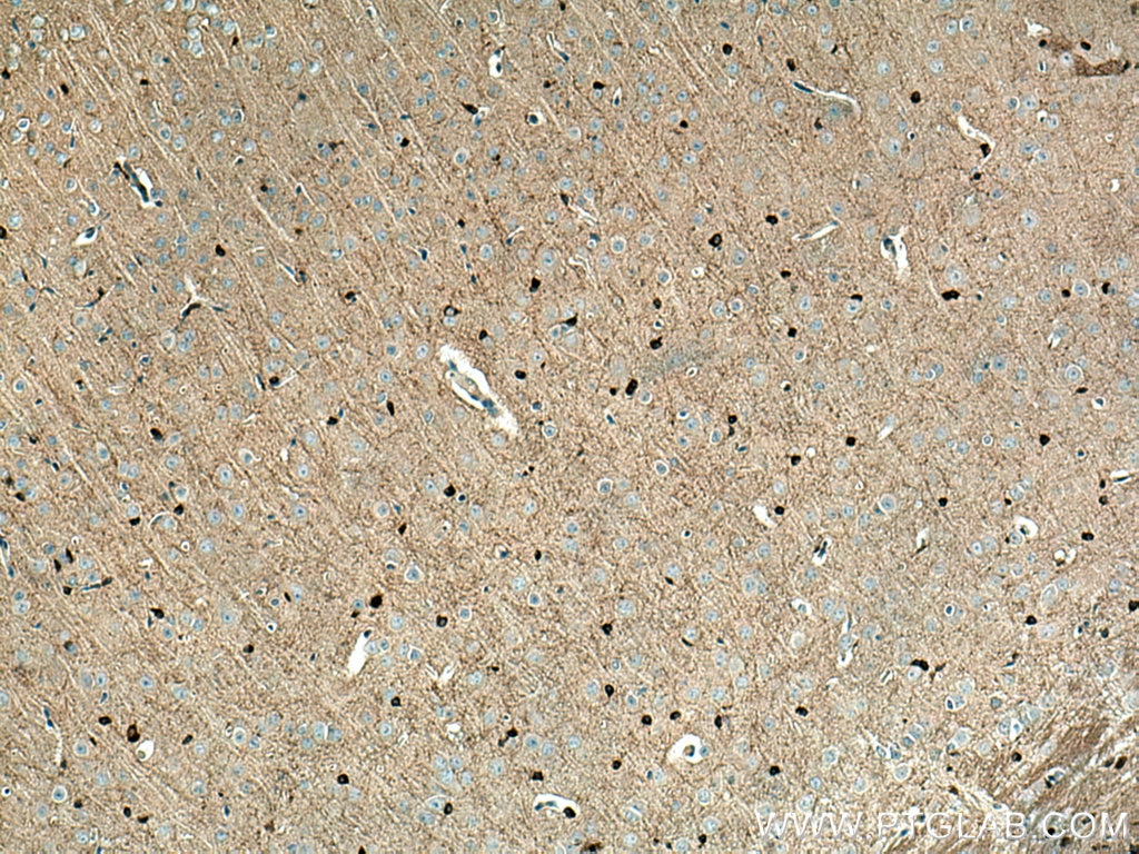 Immunohistochemistry (IHC) staining of mouse brain tissue using BIN1 Polyclonal antibody (14647-1-AP)