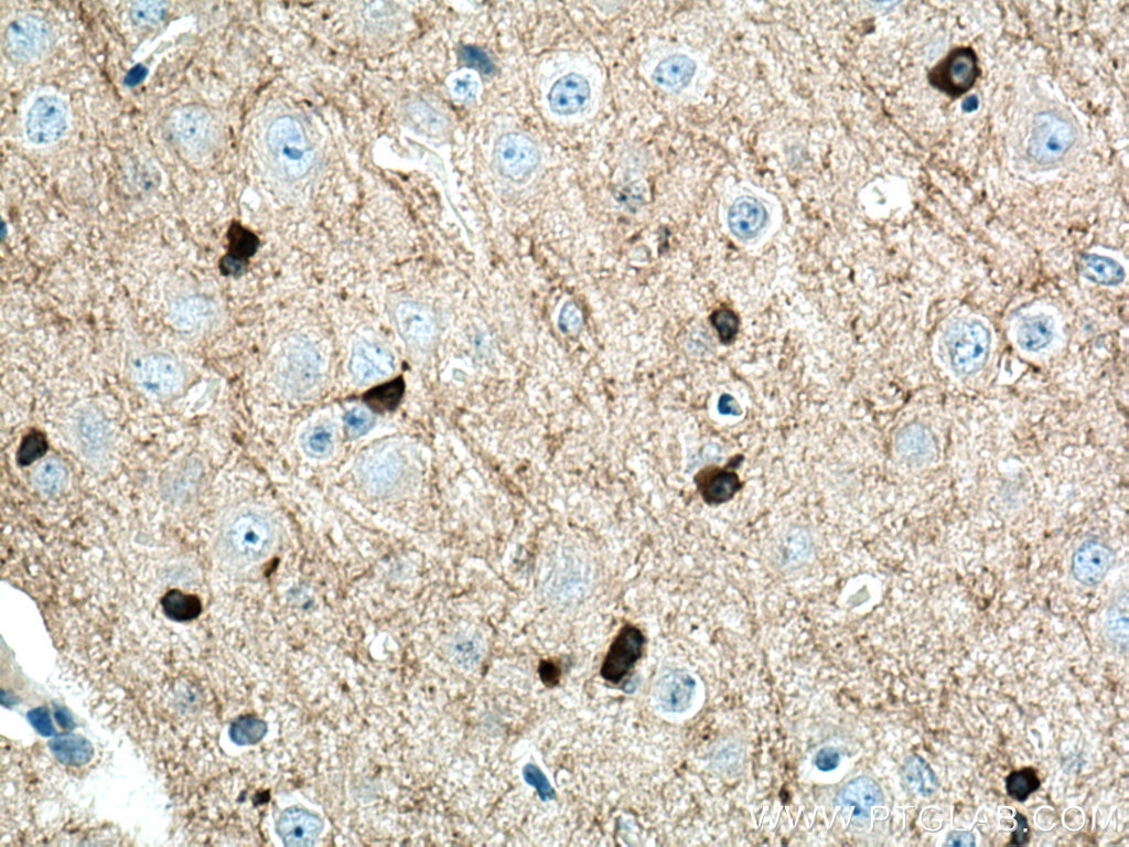 Immunohistochemistry (IHC) staining of mouse brain tissue using BIN1 Polyclonal antibody (14647-1-AP)