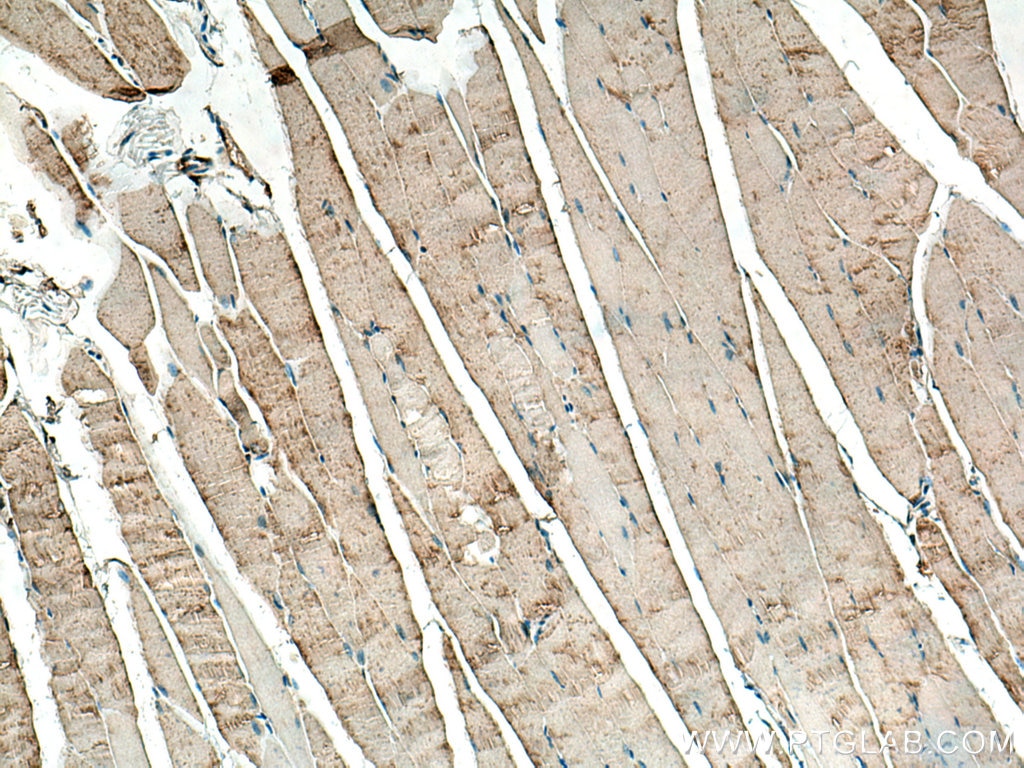 Immunohistochemistry (IHC) staining of mouse skeletal muscle tissue using BIN1 Polyclonal antibody (14647-1-AP)