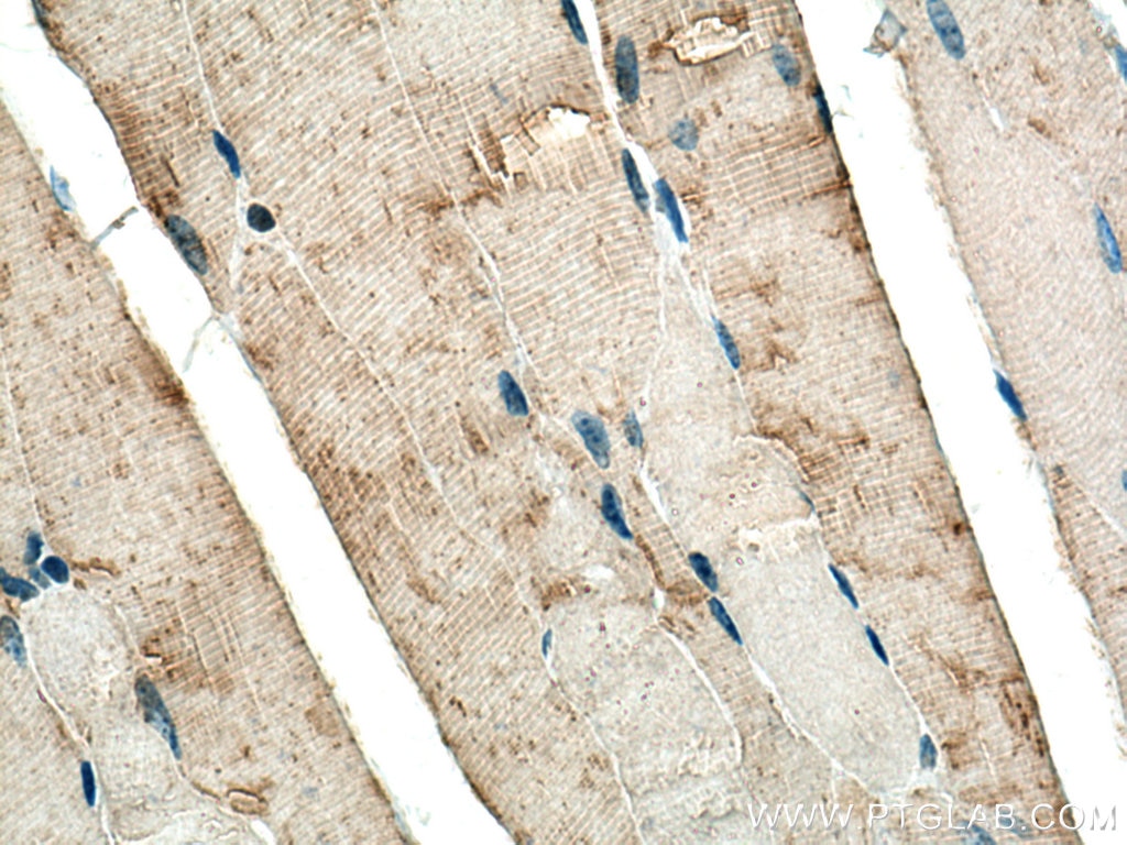 IHC staining of mouse skeletal muscle using 14647-1-AP