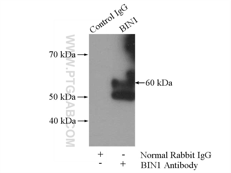 Immunoprecipitation (IP) experiment of mouse brain tissue using BIN1 Polyclonal antibody (14647-1-AP)