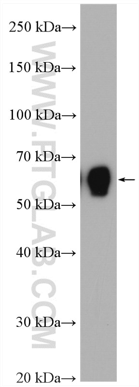 Western Blot (WB) analysis of mouse skeletal muscle tissue using BIN1 Polyclonal antibody (14647-1-AP)