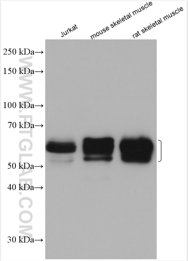 Western Blot (WB) analysis of various lysates using BIN1 Polyclonal antibody (14647-1-AP)