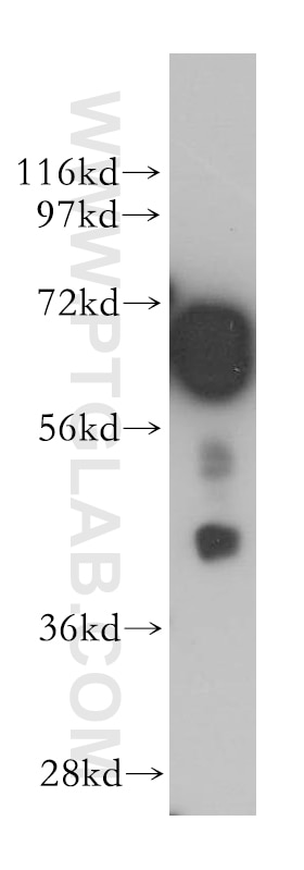 Western Blot (WB) analysis of mouse brain tissue using BIN1 Polyclonal antibody (14647-1-AP)