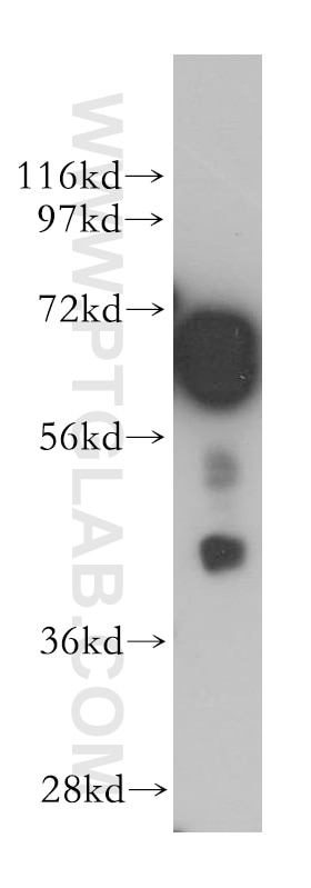 WB analysis of mouse brain using 14647-1-AP