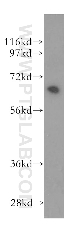 Western Blot (WB) analysis of Jurkat cells using BIN1 Polyclonal antibody (14647-1-AP)