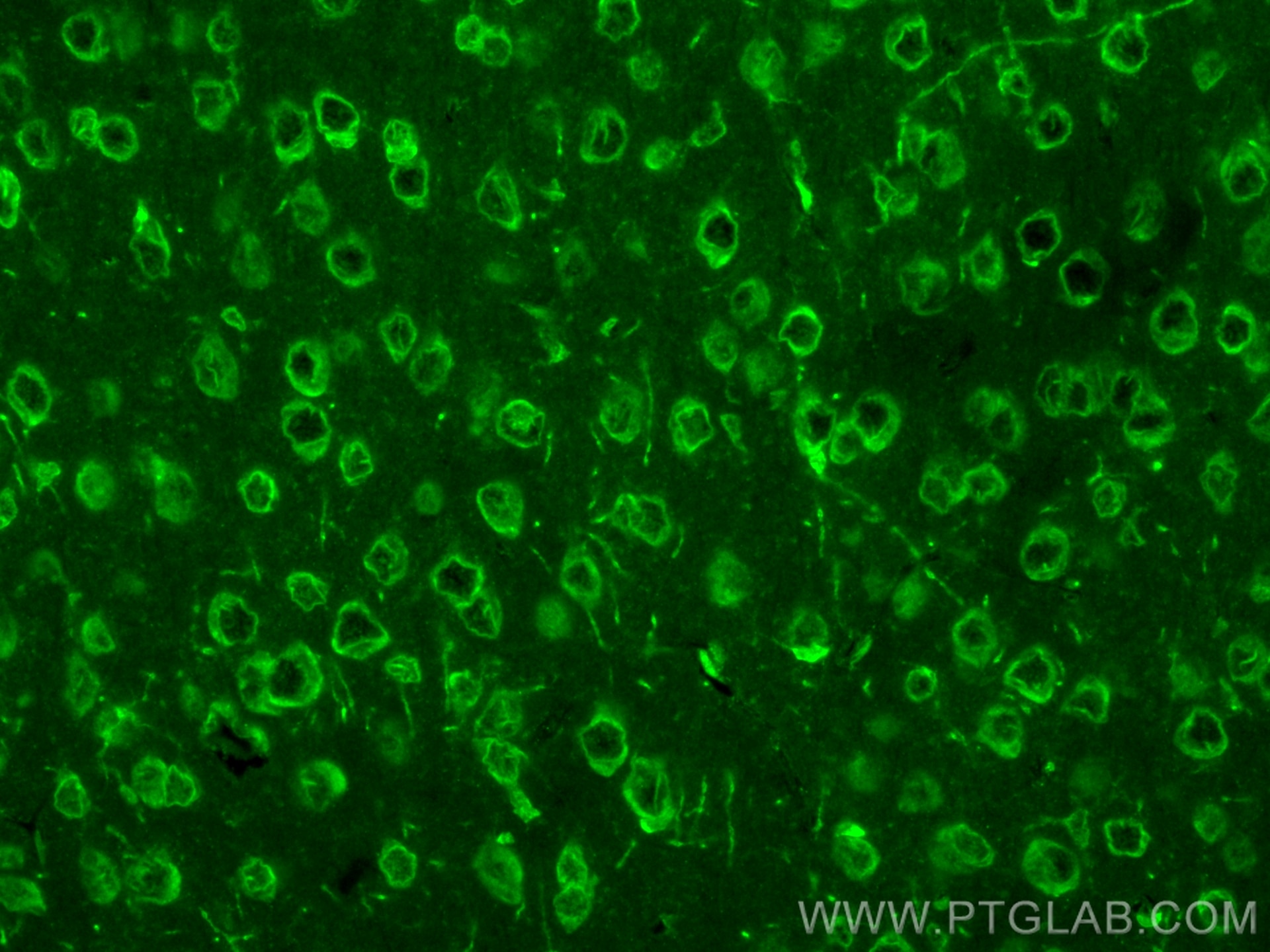 IF Staining of mouse brain using CL488-14647