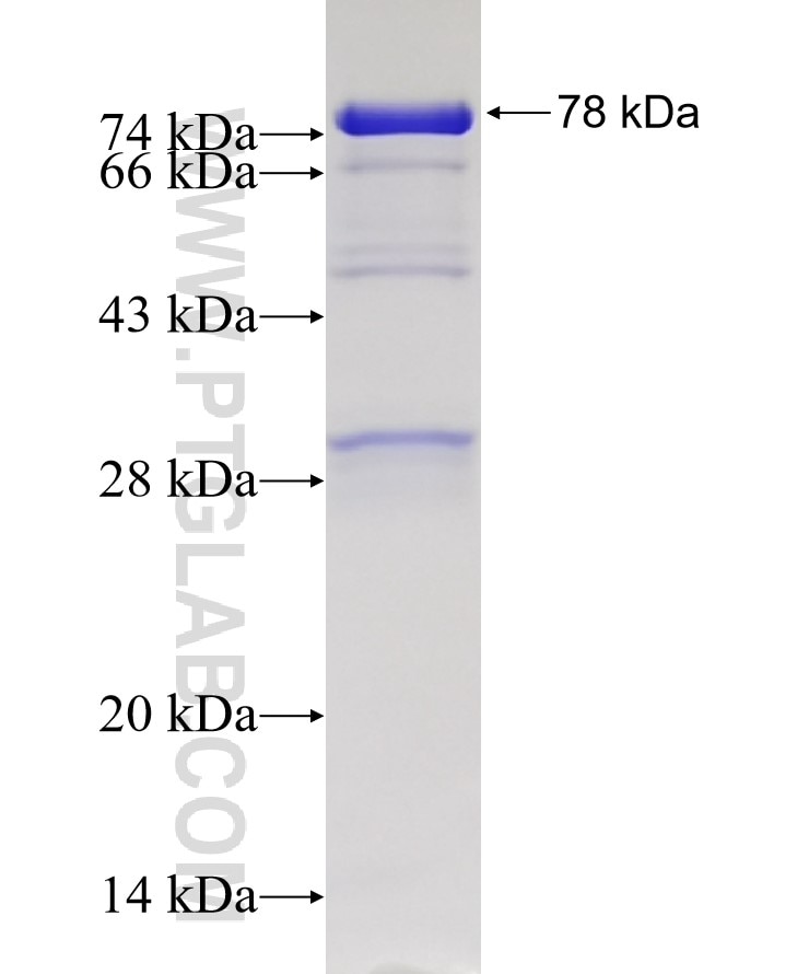 BIN1 fusion protein Ag6240 SDS-PAGE