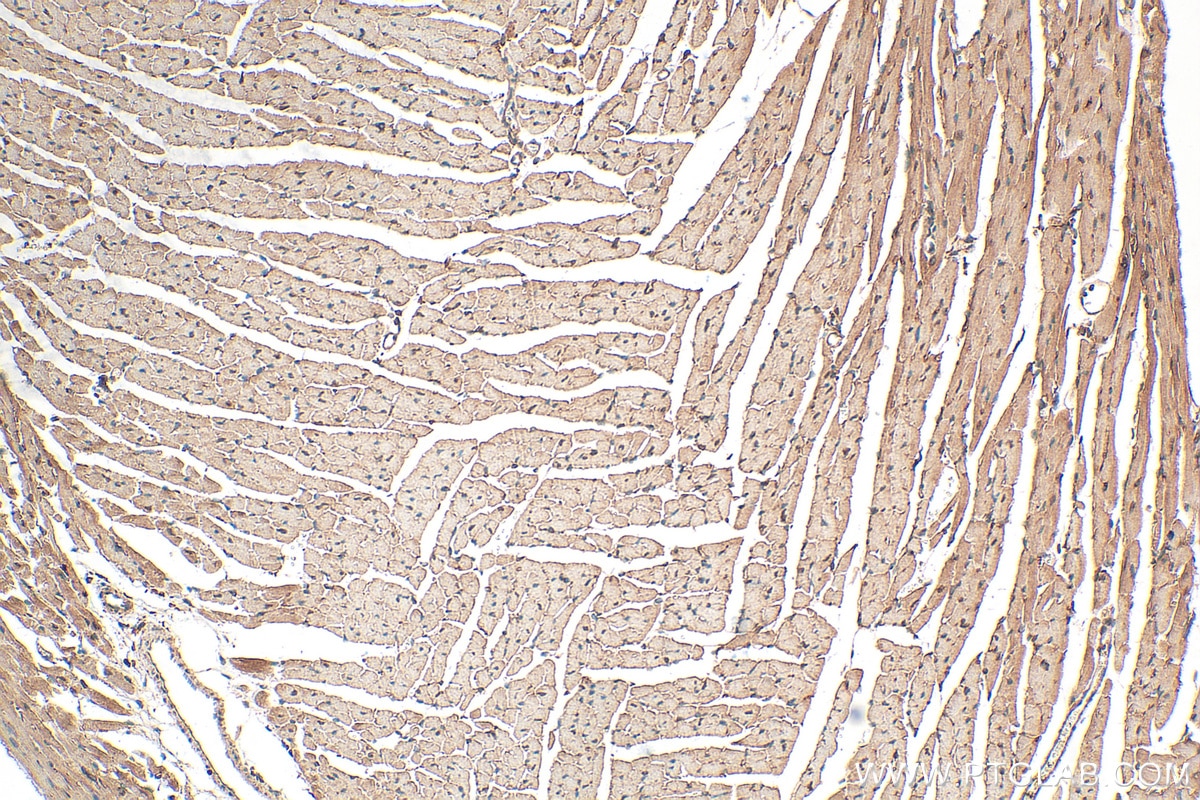 IHC staining of mouse heart using 14245-1-AP