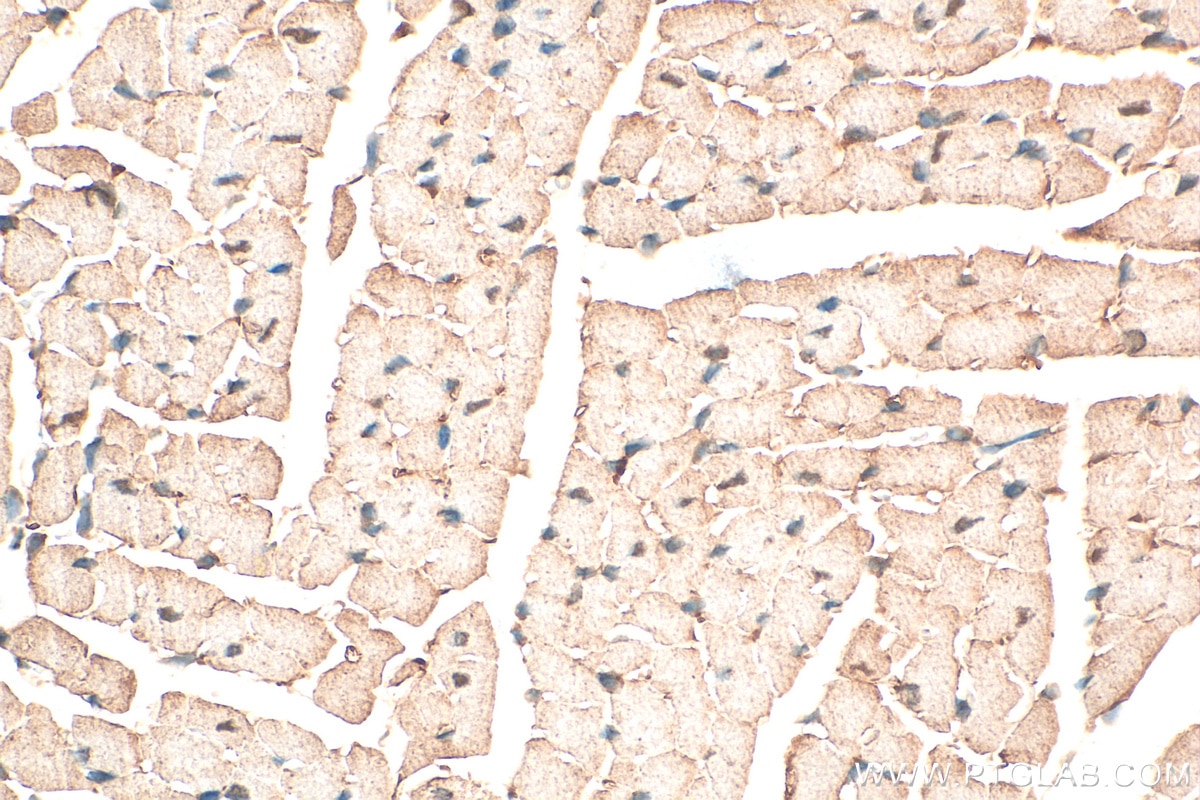 Immunohistochemistry (IHC) staining of mouse heart tissue using BIN2 Polyclonal antibody (14245-1-AP)