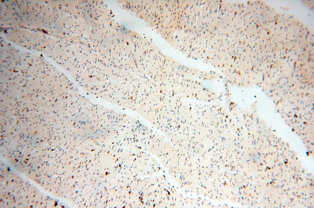 IHC staining of human heart using 14245-1-AP