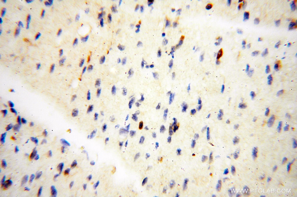 Immunohistochemistry (IHC) staining of human heart tissue using BIN2 Polyclonal antibody (14245-1-AP)