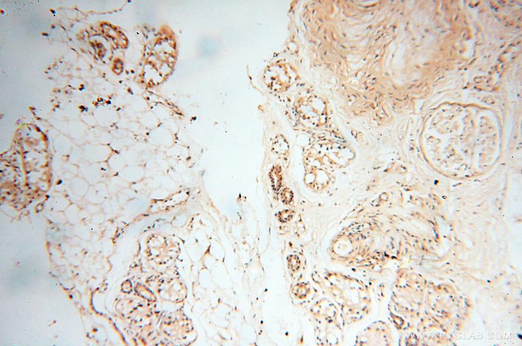 Immunohistochemistry (IHC) staining of human skin tissue using BIN2 Polyclonal antibody (14245-1-AP)