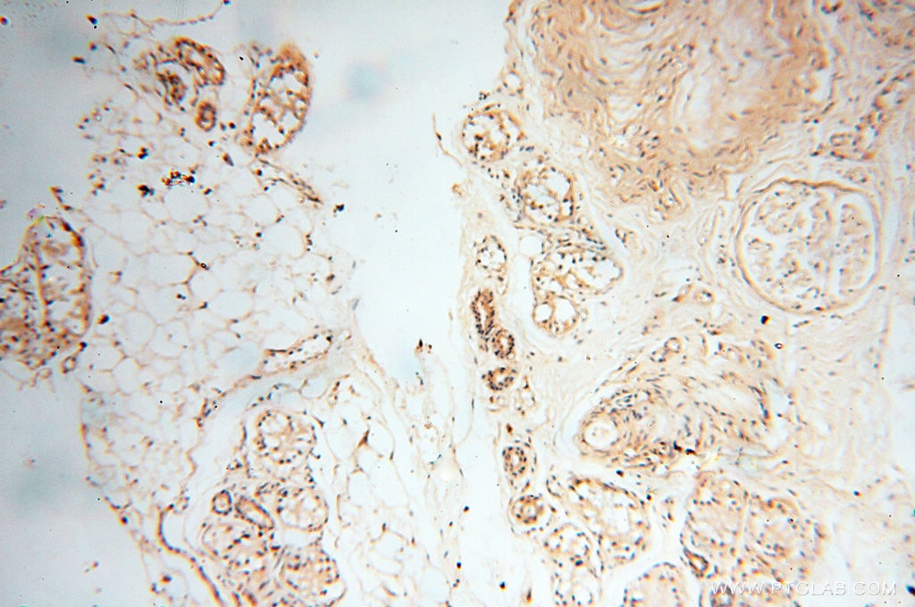 IHC staining of human skin using 14245-1-AP