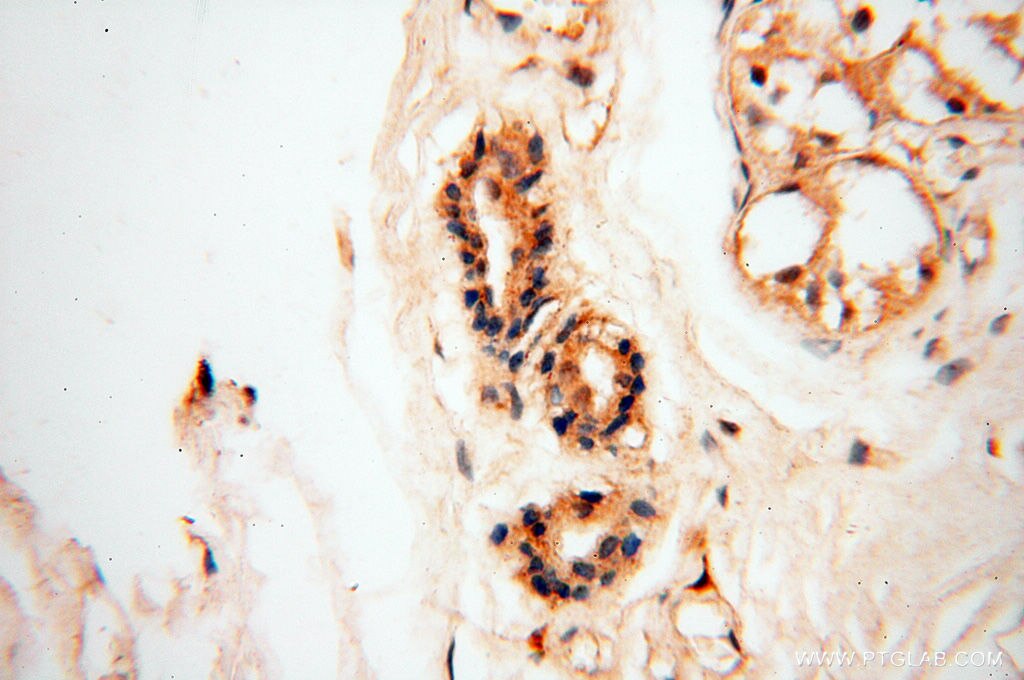 Immunohistochemistry (IHC) staining of human skin tissue using BIN2 Polyclonal antibody (14245-1-AP)