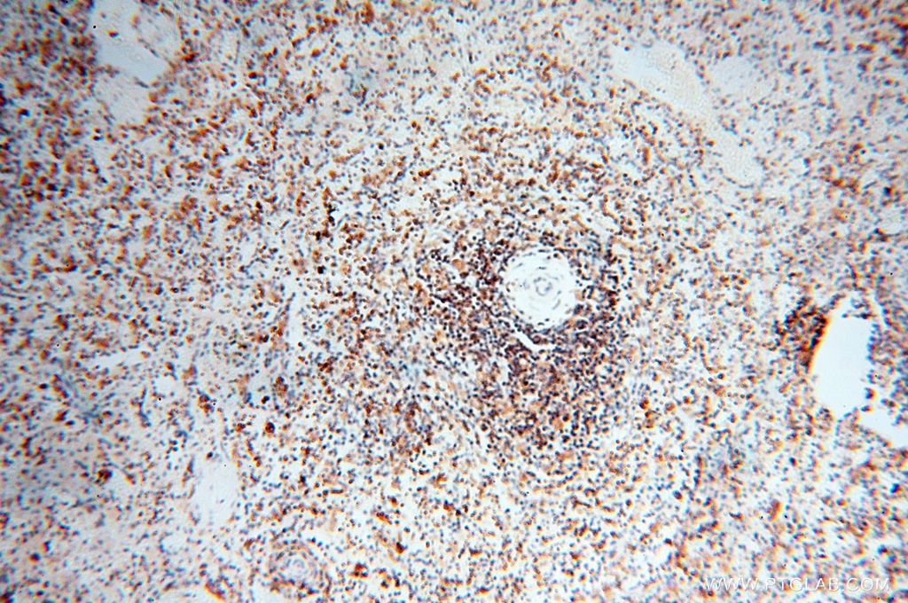 Immunohistochemistry (IHC) staining of human spleen tissue using BIN2 Polyclonal antibody (14245-1-AP)