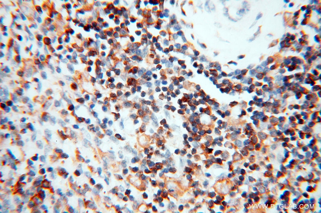 Immunohistochemistry (IHC) staining of human spleen tissue using BIN2 Polyclonal antibody (14245-1-AP)