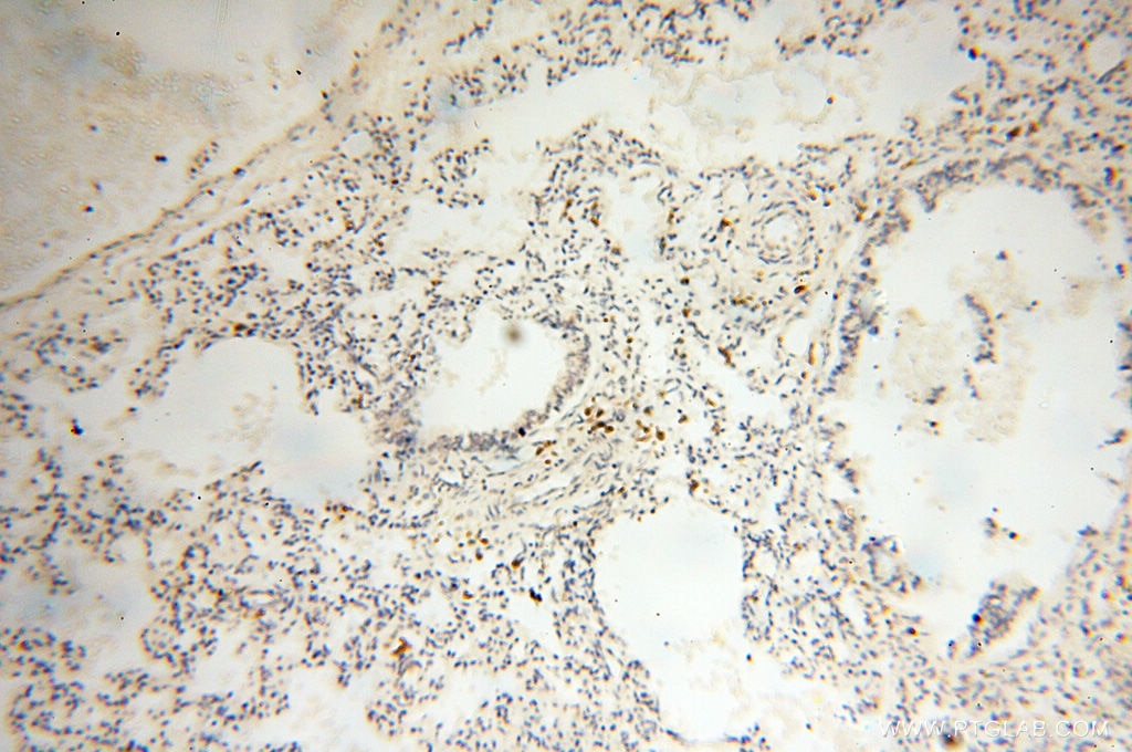 Immunohistochemistry (IHC) staining of human lung tissue using BIN2 Polyclonal antibody (14245-1-AP)