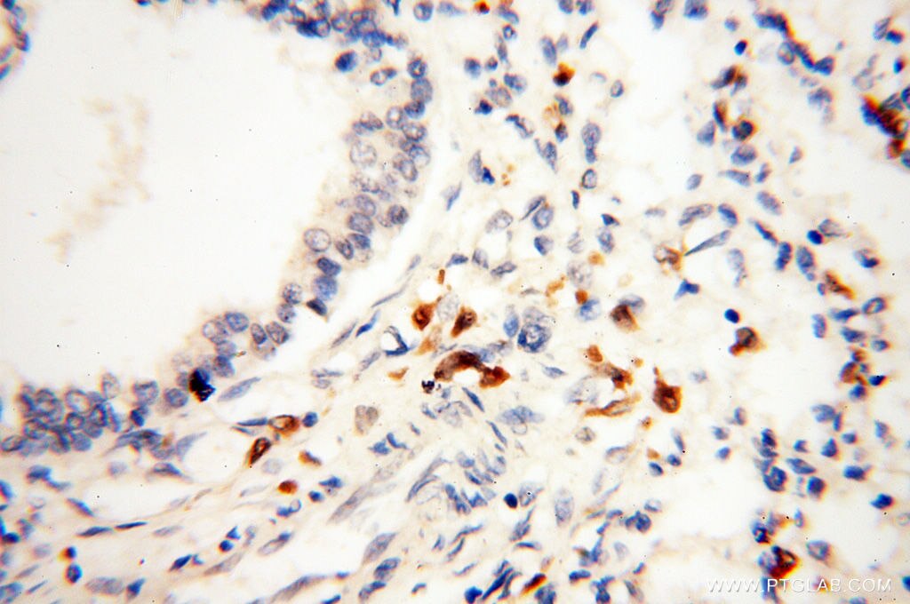 Immunohistochemistry (IHC) staining of human lung tissue using BIN2 Polyclonal antibody (14245-1-AP)