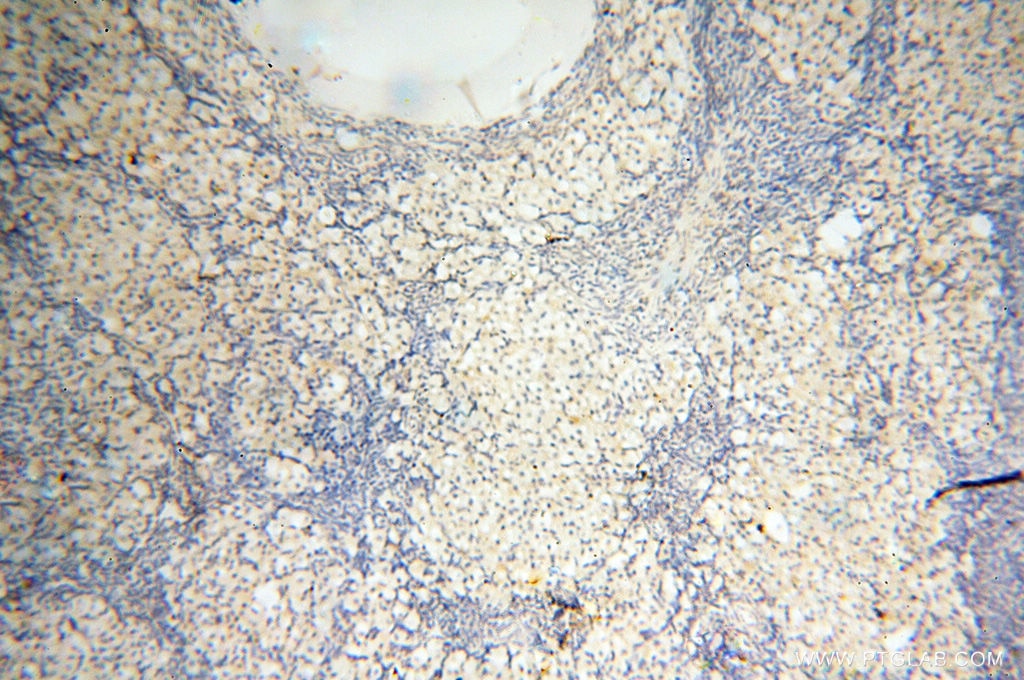 Immunohistochemistry (IHC) staining of human ovary tissue using BIN2 Polyclonal antibody (14245-1-AP)