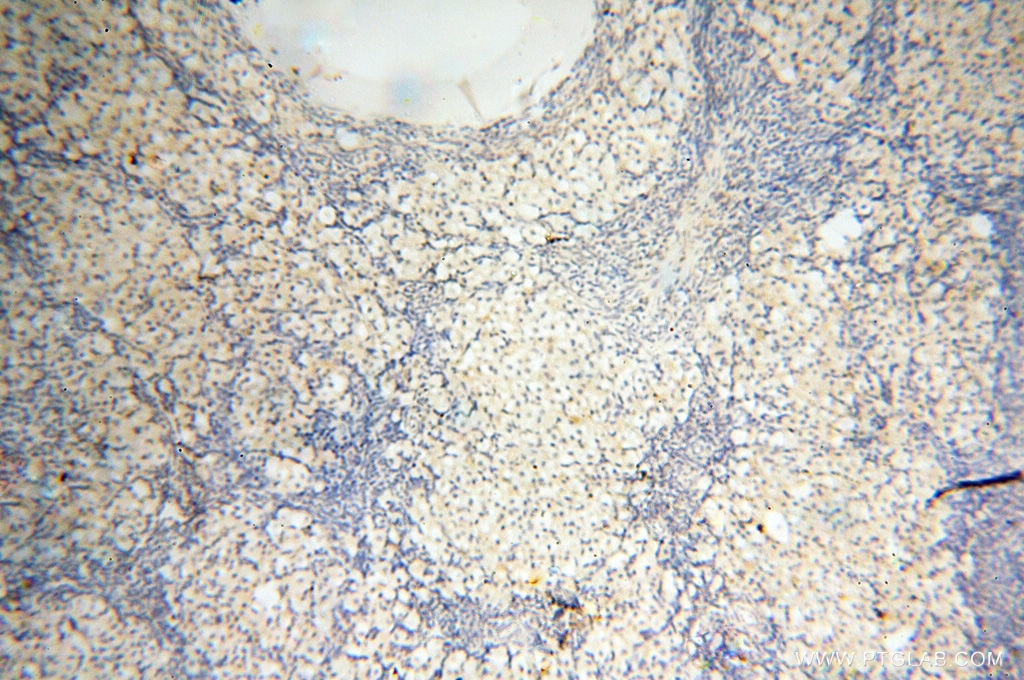 IHC staining of human ovary using 14245-1-AP