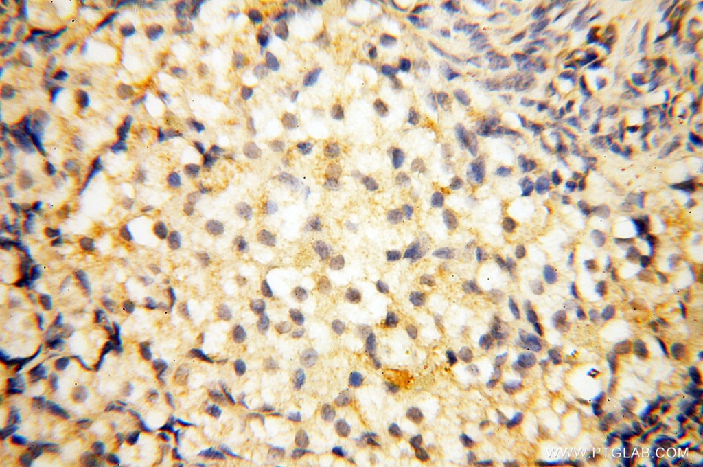 Immunohistochemistry (IHC) staining of human ovary tissue using BIN2 Polyclonal antibody (14245-1-AP)