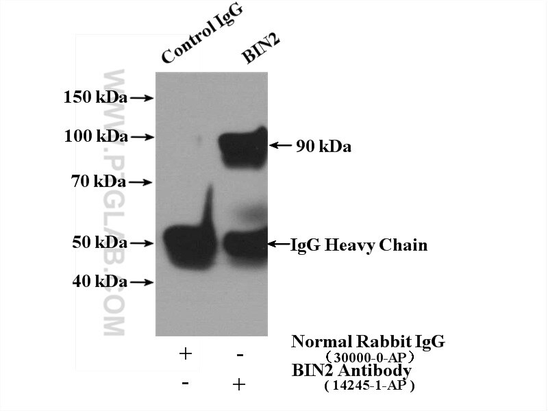 Immunoprecipitation (IP) experiment of Jurkat cells using BIN2 Polyclonal antibody (14245-1-AP)