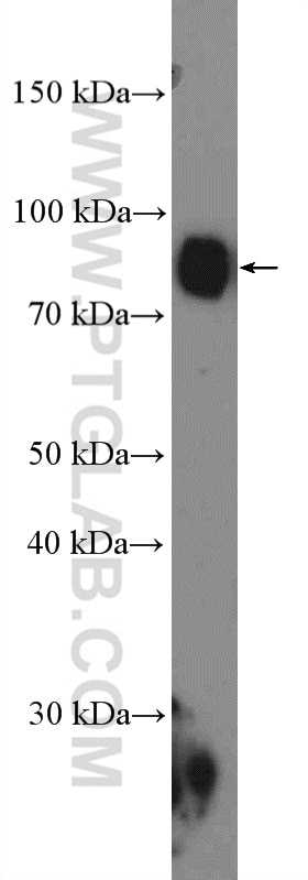 Western Blot (WB) analysis of U-937 cells using BIN2 Polyclonal antibody (14245-1-AP)