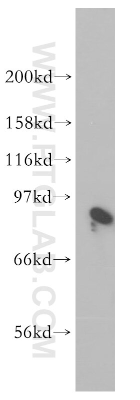 Western Blot (WB) analysis of Jurkat cells using BIN2 Polyclonal antibody (14245-1-AP)