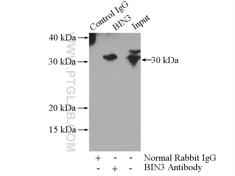 Immunoprecipitation (IP) experiment of K-562 cells using BIN3 Polyclonal antibody (11215-1-AP)