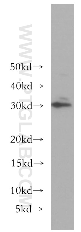 Western Blot (WB) analysis of K-562 cells using BIN3 Polyclonal antibody (11215-1-AP)