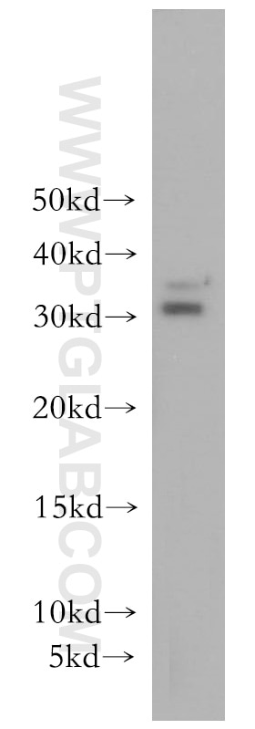 Western Blot (WB) analysis of HeLa cells using BIN3 Polyclonal antibody (11215-1-AP)