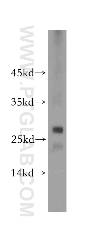 Western Blot (WB) analysis of Jurkat cells using BIN3 Polyclonal antibody (20186-1-AP)