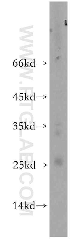 Western Blot (WB) analysis of HeLa cells using BIN3 Polyclonal antibody (20186-1-AP)